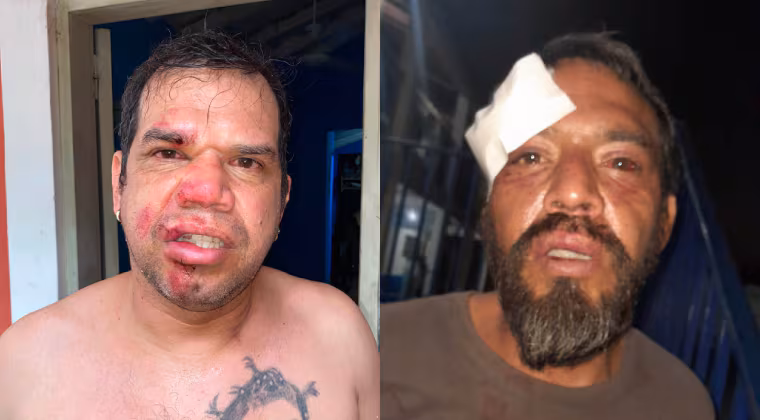 Hermanos denuncian brutal golpiza de agentes y Policía abre investigación