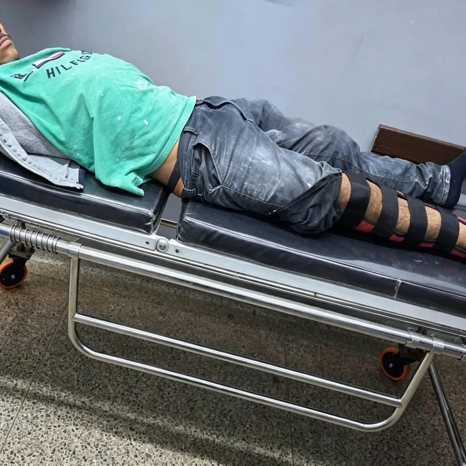 Accidente en Jardín Aurora deja a adolescente de 17 años con fractura de tibia