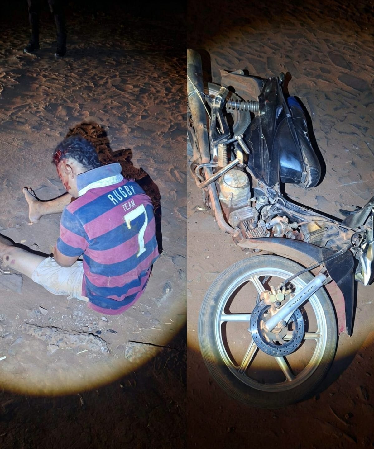 Motociclista sufre hemorragia cerebral tras aparatosa caída en PJC
