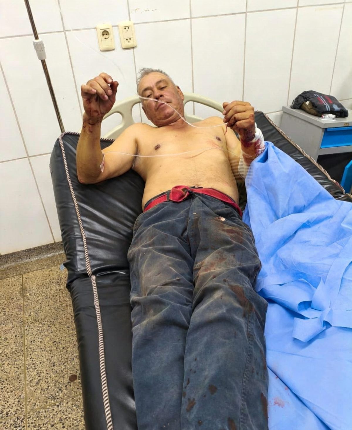 Atacan con machetillo a un hombre mientras caminaba por el barrio General Díaz
