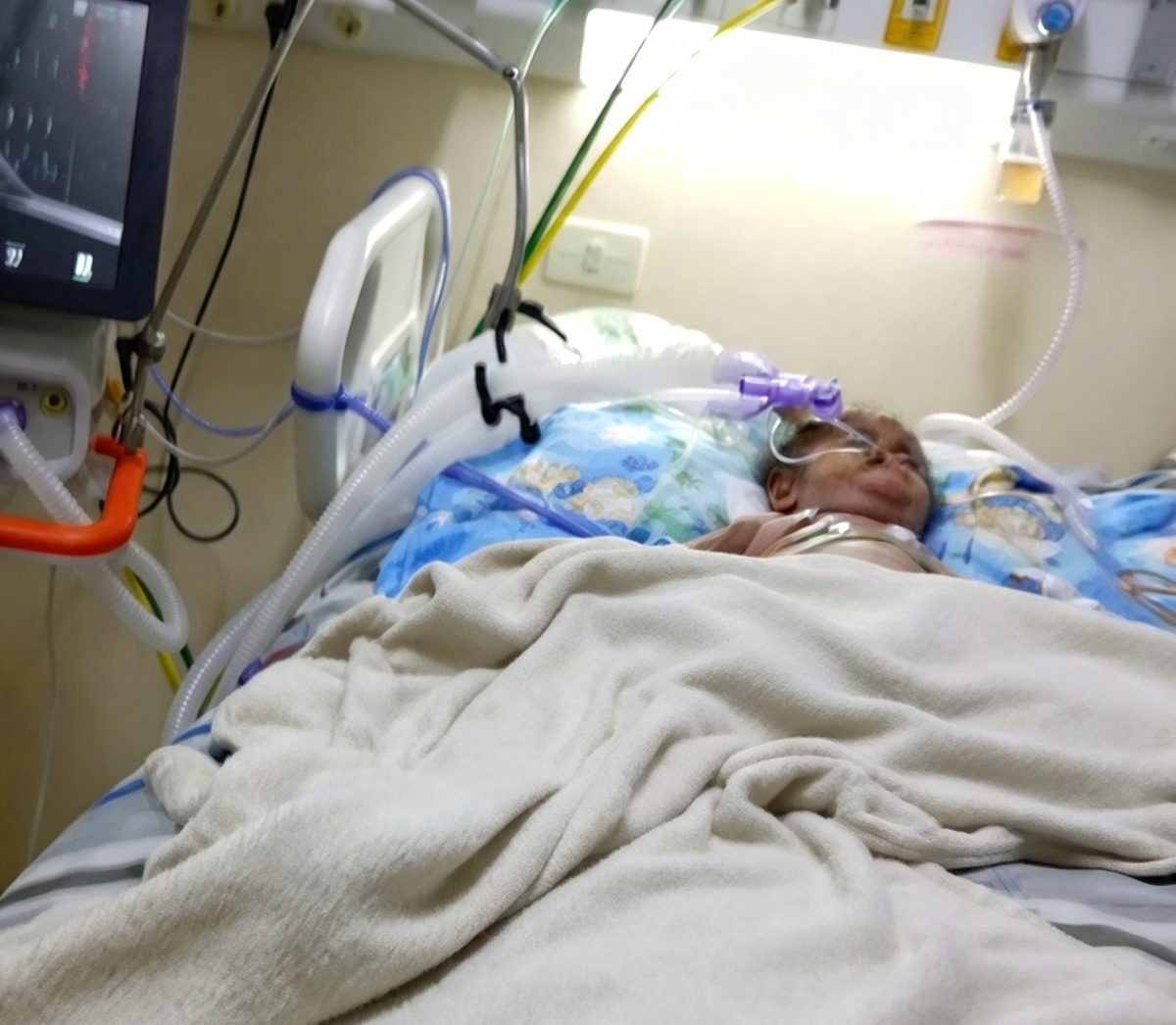Bebé pedrojuanino permanece internado y su familia necesita G. 3 millones para un estudio genético